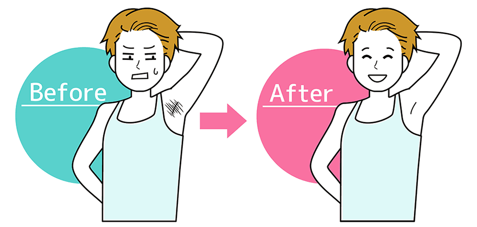 Before After