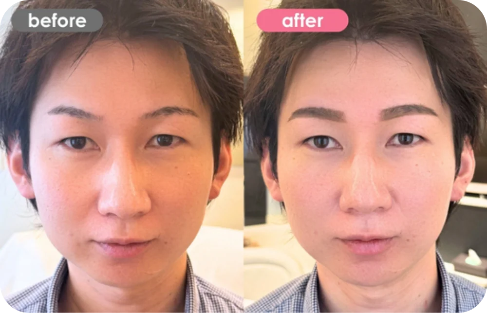 症例写真