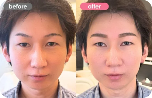 症例写真