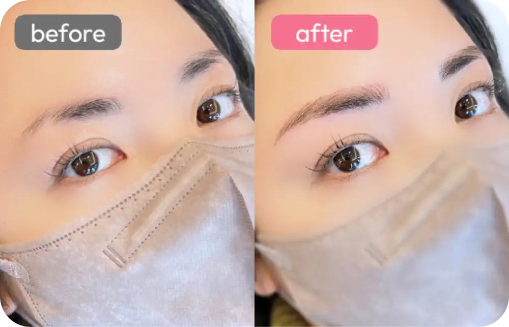 症例写真