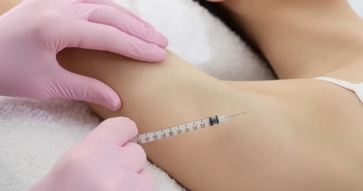 ボトックス注射で汗止め!不快感解消に治療が有効