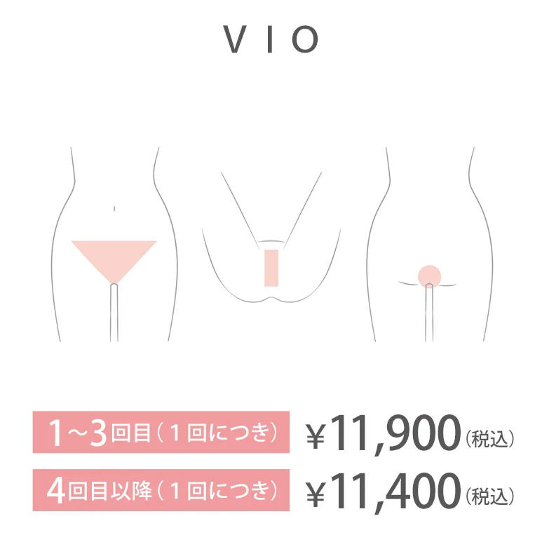 VIO
