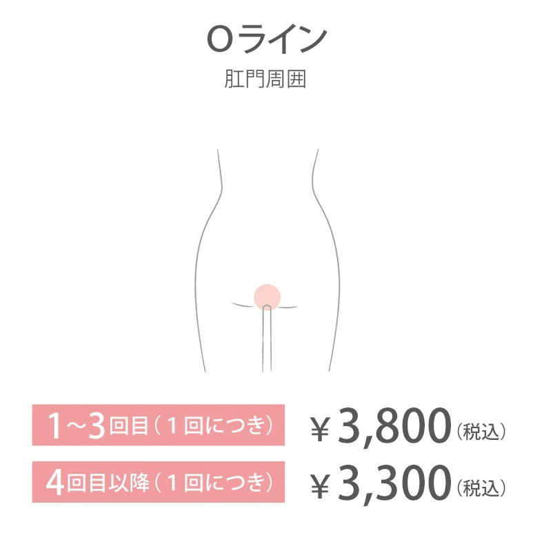Oライン