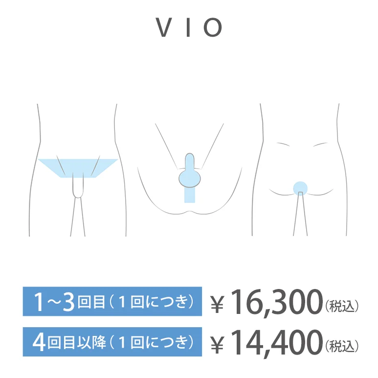 VIO