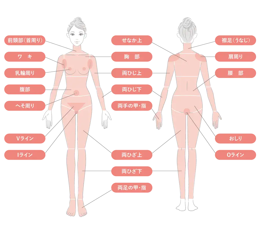 医療脱毛(照射部位)