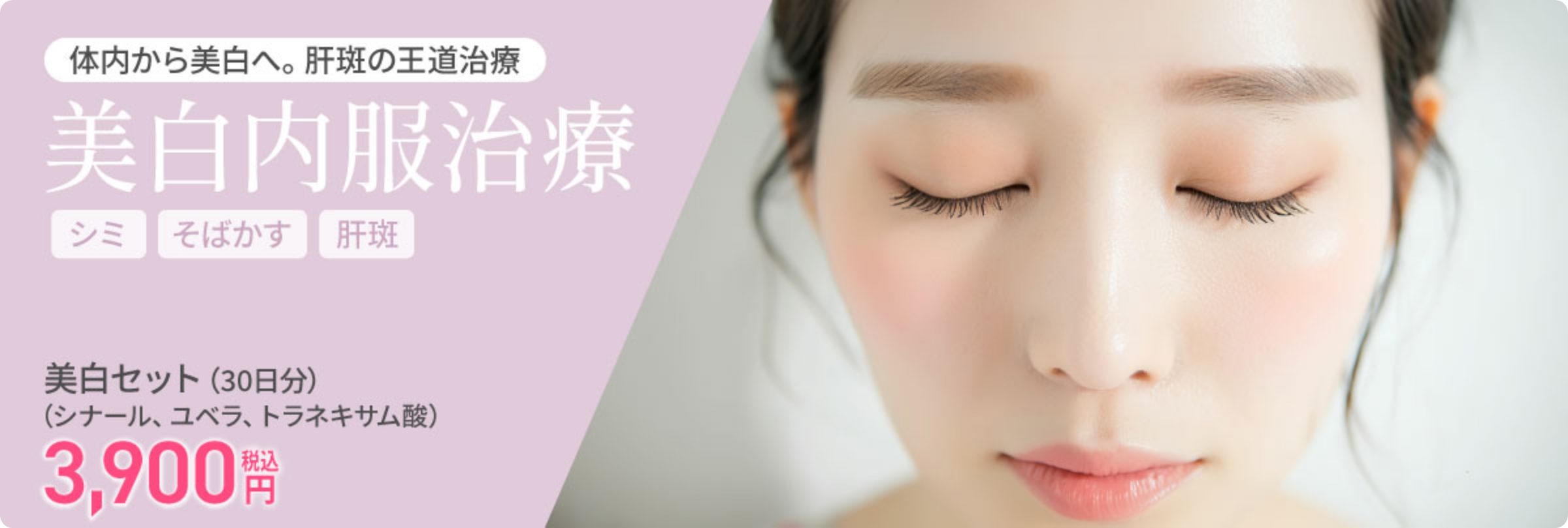 美白内服治療