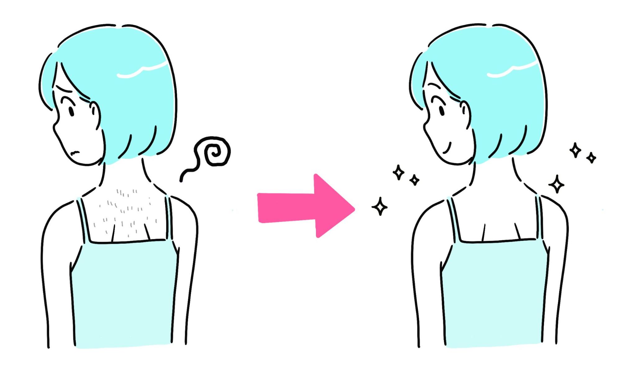 脱毛の悩み