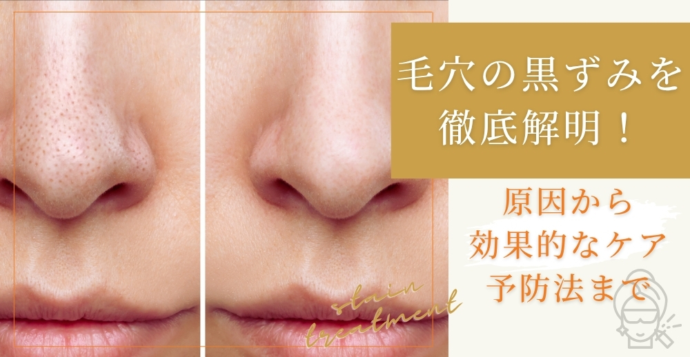 毛穴の黒ずみを徹底解明！原因から効果的なケア・予防法まで
