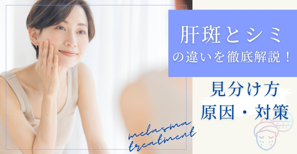 肝斑とシミの違いを徹底解説！見分け方・原因・対策まで