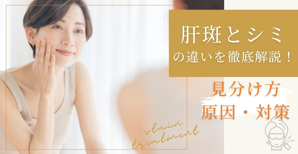 肝斑とシミの違いを徹底解説！見分け方・原因・対策まで