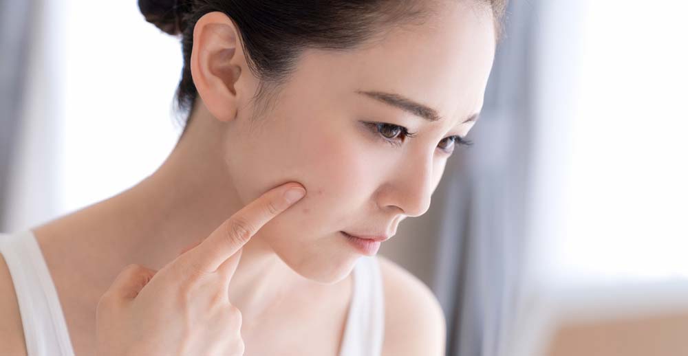 シミとホクロの違いを徹底解説:原因・見分け方・治療法までまるごと網羅