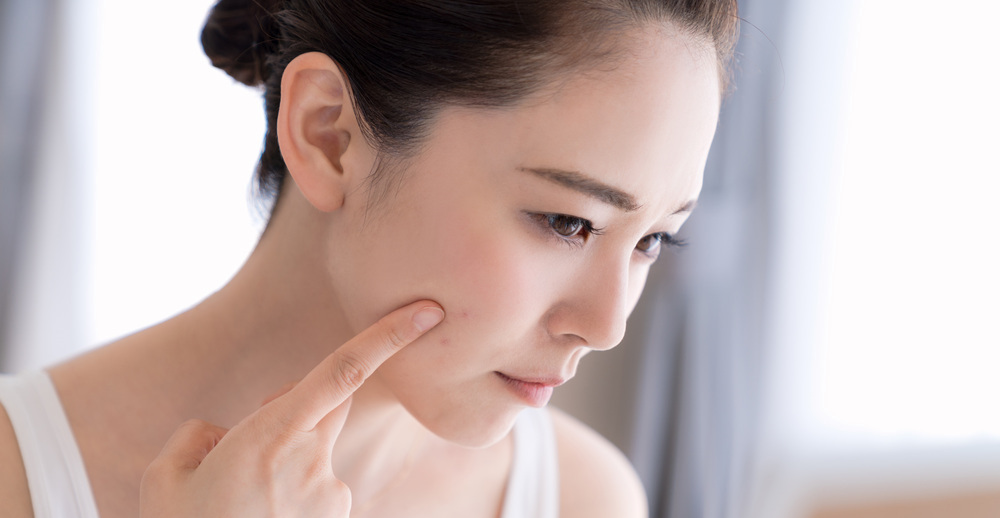 シミ取りレーザー後にかさぶたにならない・黒いままの原因と対処法を徹底解説