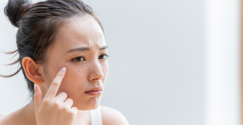 「肌が汚い」とは？その定義と見た目の特徴