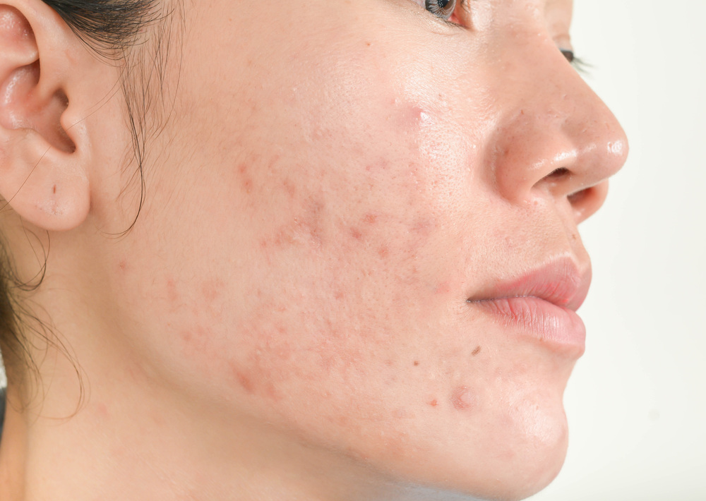 「肌が汚い」とは？その定義と見た目の特徴