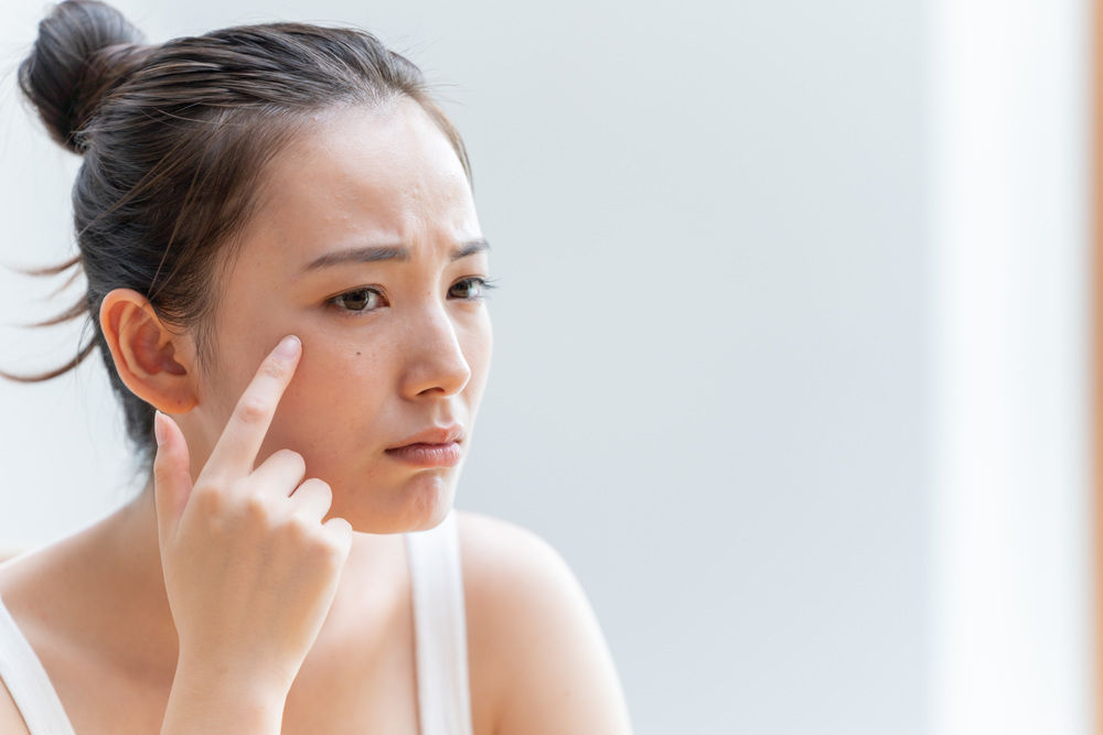 ボトックスをやめるとどうなる？気になる疑問や不安を徹底解説