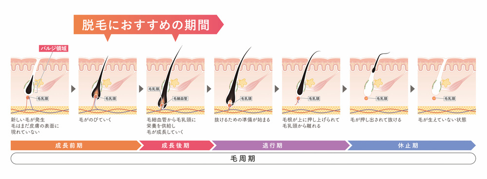 熱破壊式 医療脱毛