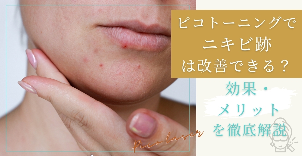 ピコトーニングでニキビ跡は改善できる?効果・メリットを徹底解説