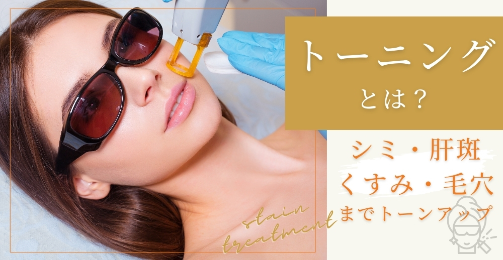 トーニングとは?シミ・肝斑・くすみから毛穴までトーンアップを目指す美肌施術