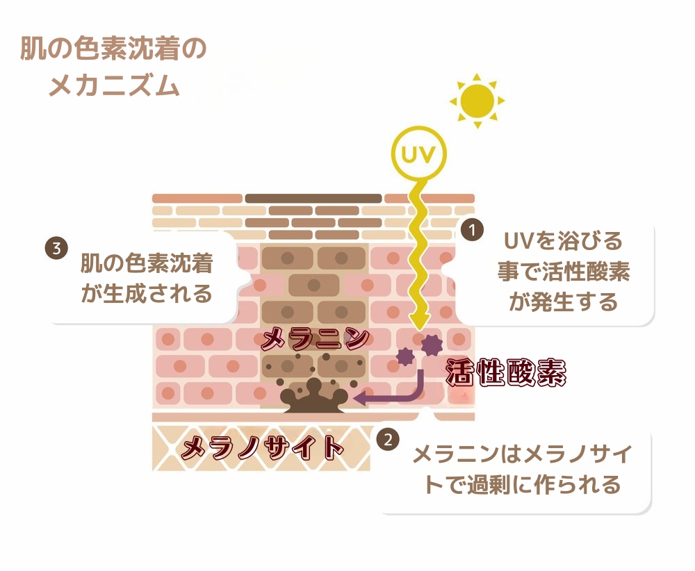 レーザーでシミ取り
