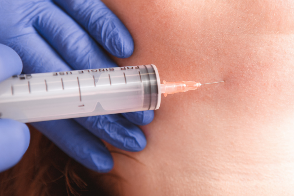 なんば ボトックス