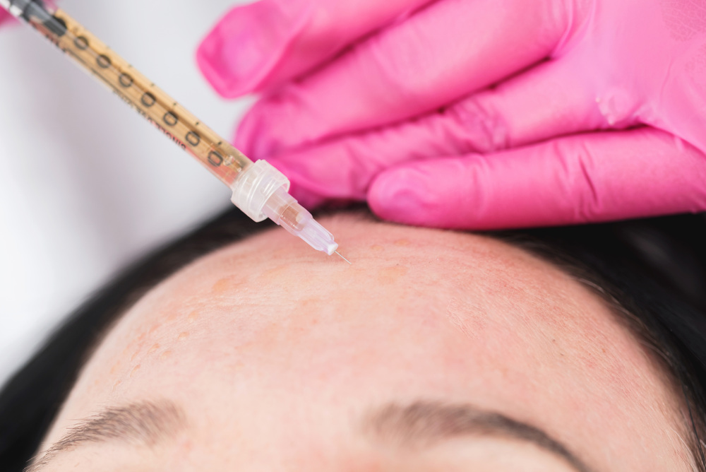 大阪 シワ 治療