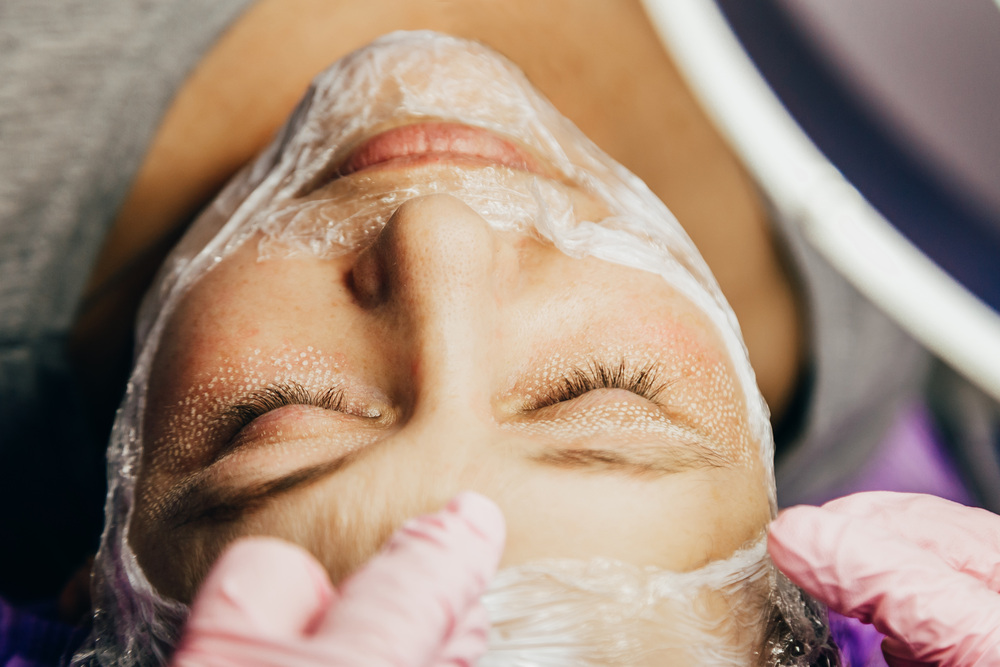 フラクショナルレーザー 大阪 安い