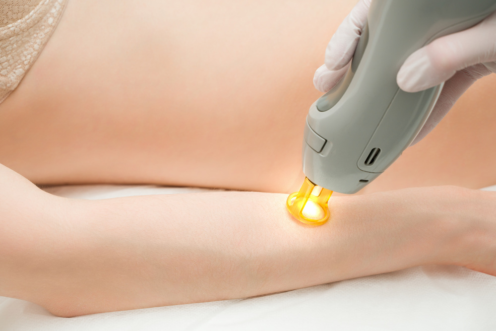 医療脱毛 大阪 人気