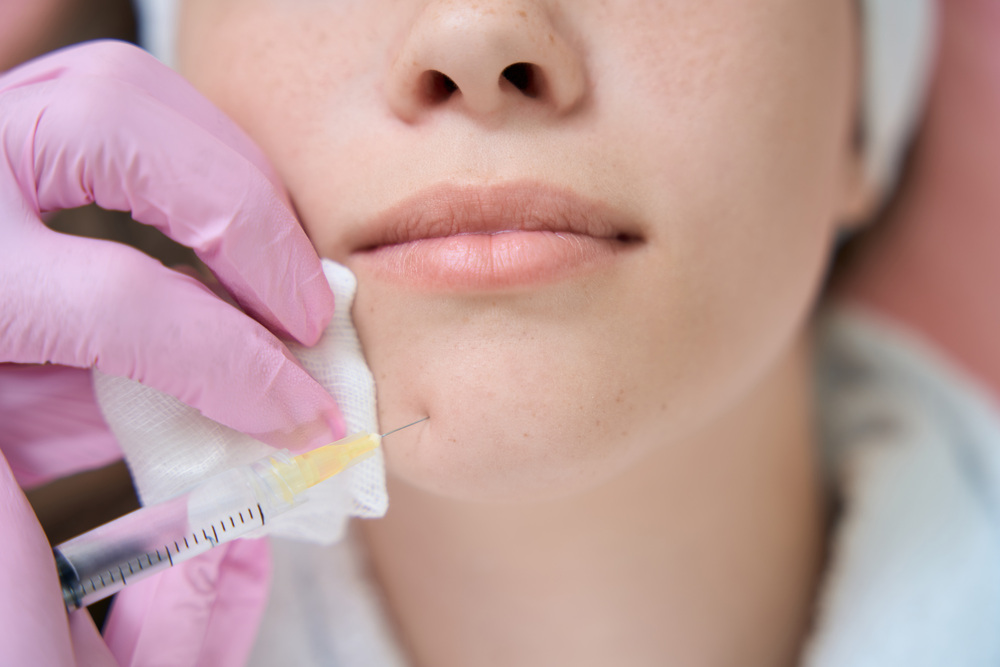 大阪 シワ 治療