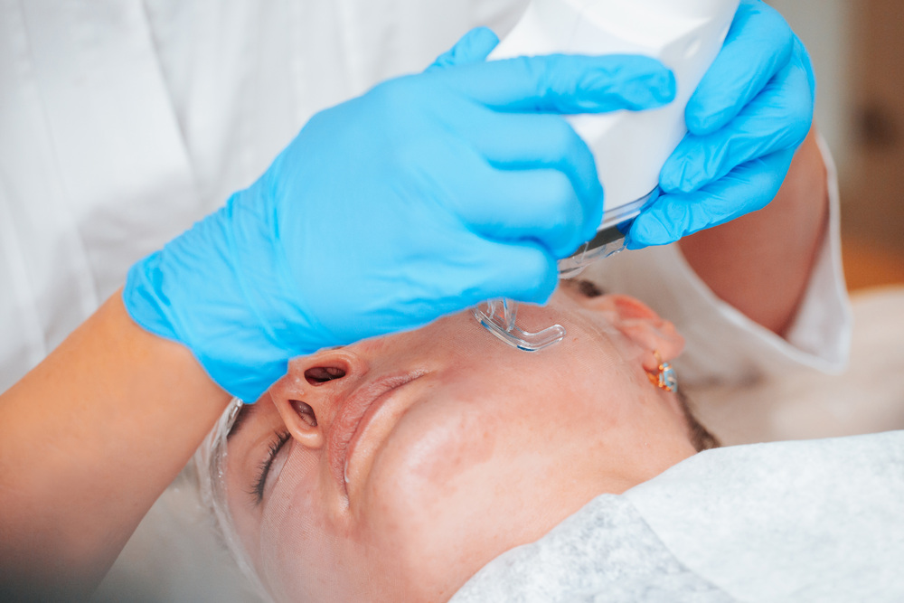 フラクショナルレーザー 大阪 安い