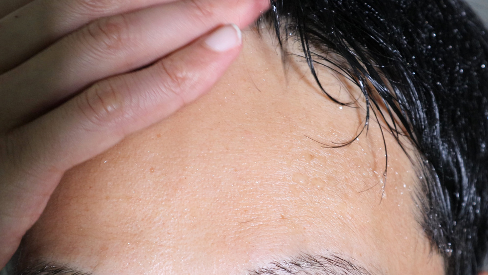 心斎橋 多汗症 治療