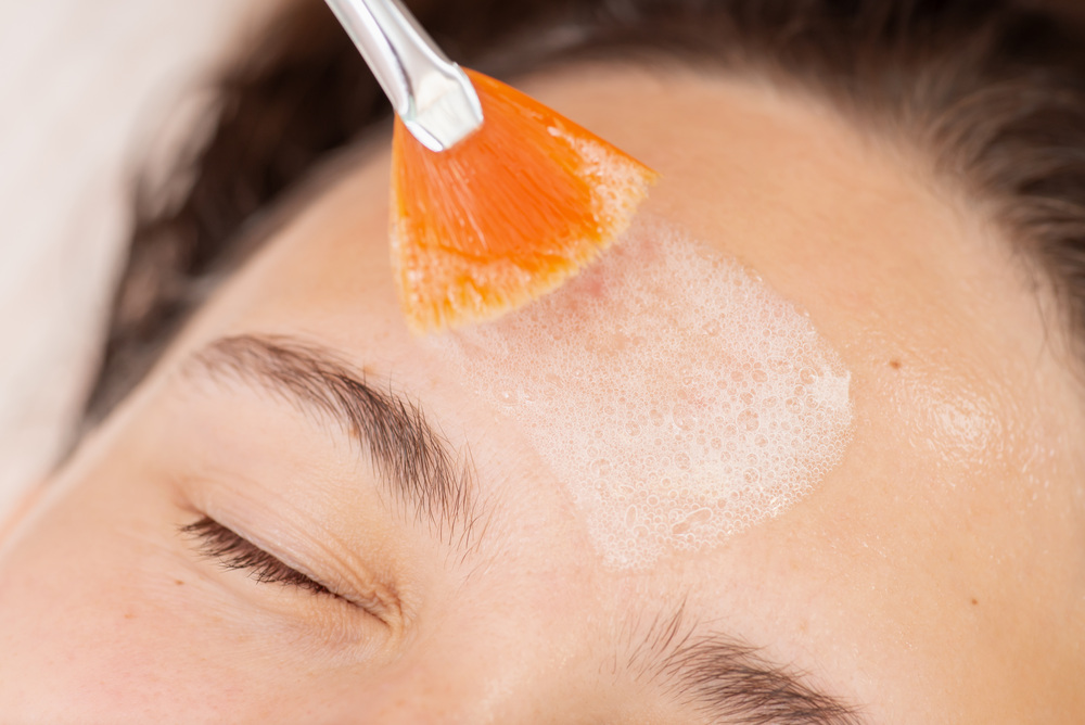 ケミカルピーリング 大阪 安い