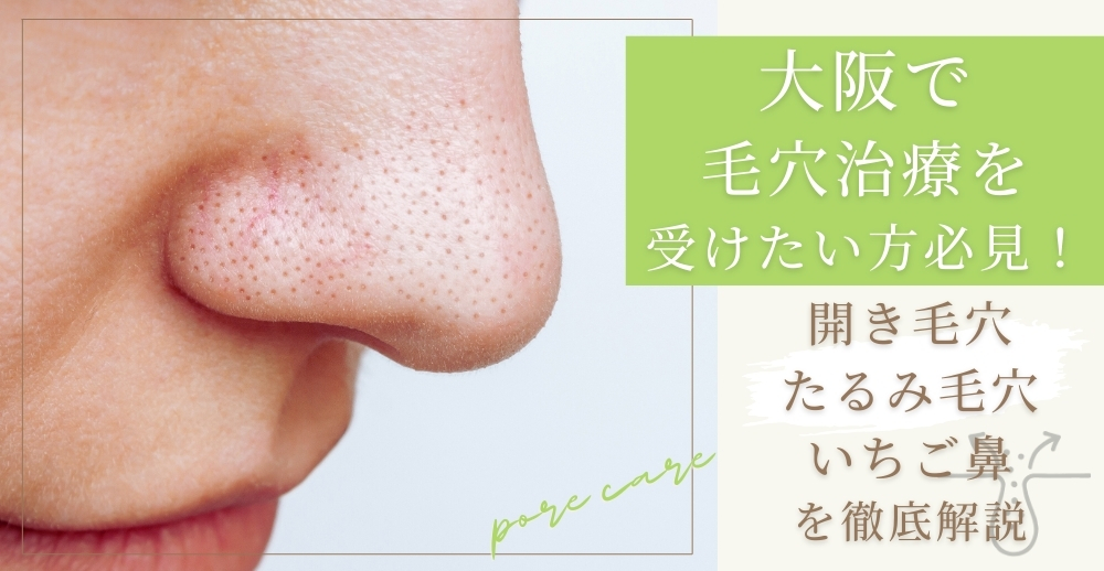 大阪で毛穴治療を受けたい方必見！開き毛穴・たるみ毛穴・いちご鼻を徹底解説