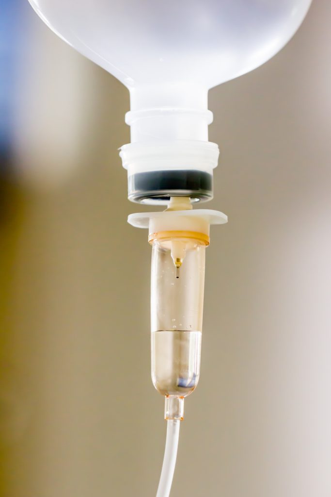 【最新版】大阪で安く美容点滴を受けたい方必見。白玉点滴・高濃度ビタミンC点滴など人気施術の効果や料金相場、クリニック選びのポイントを徹底解説。コスパよく美肌を目指すガイドです。