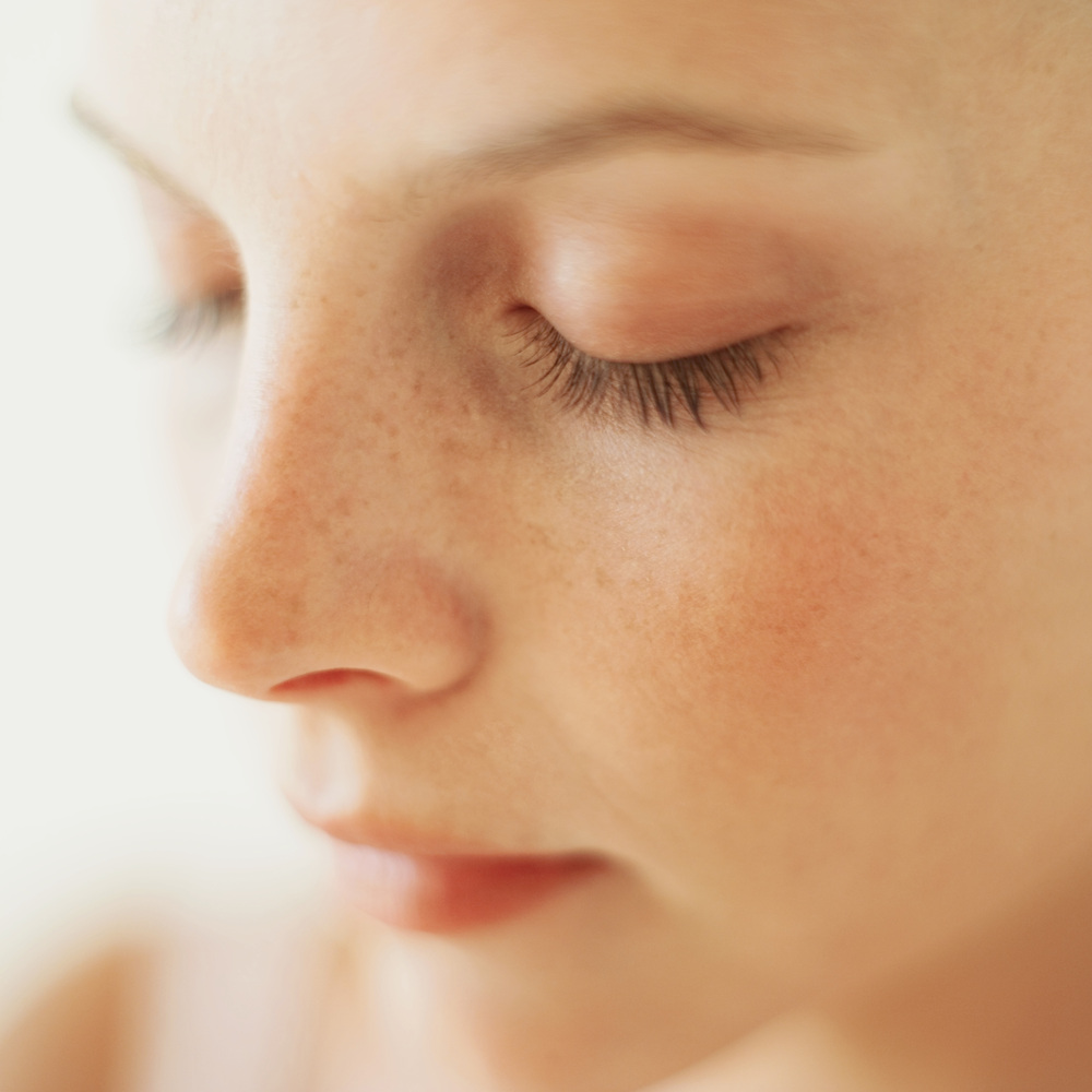 そばかす レーザー 大阪 安い