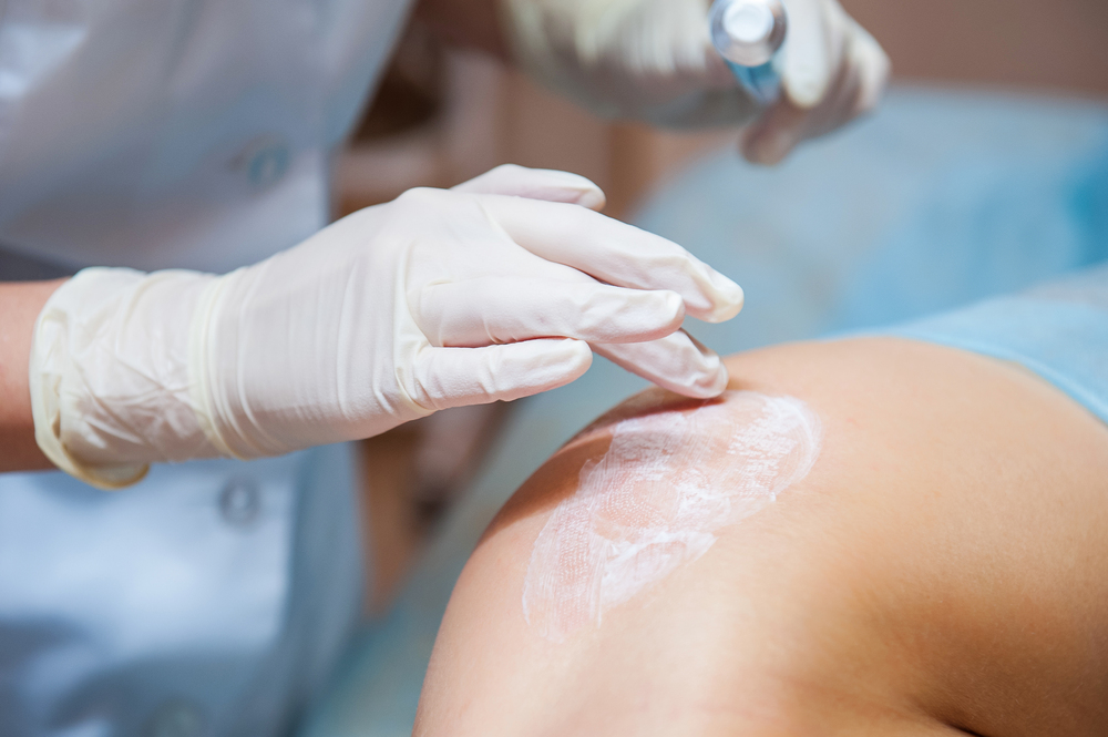 大阪 毛穴 治療