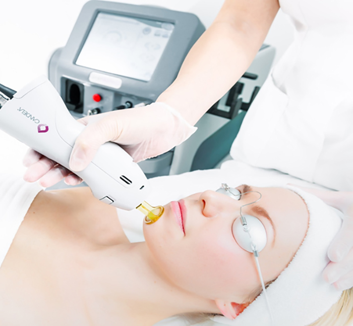 シミ 皮膚科 大阪