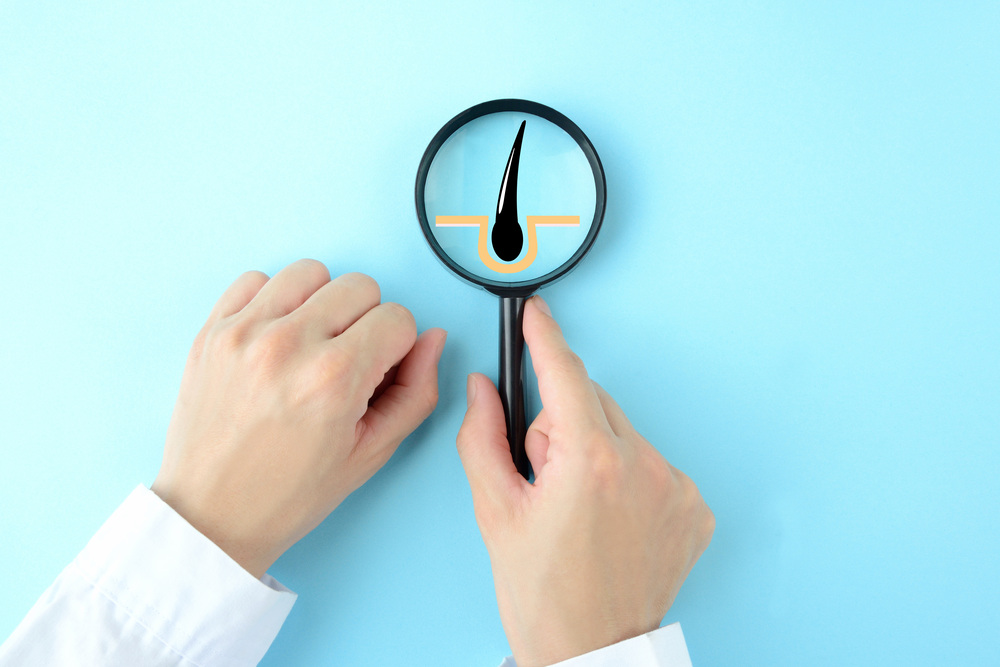 毛根を観察している様子