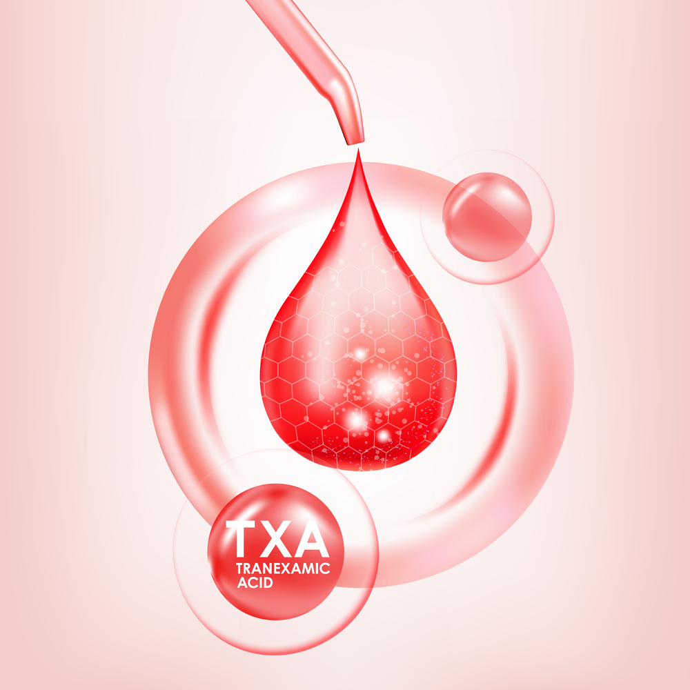 トラネキサム酸のイメージ