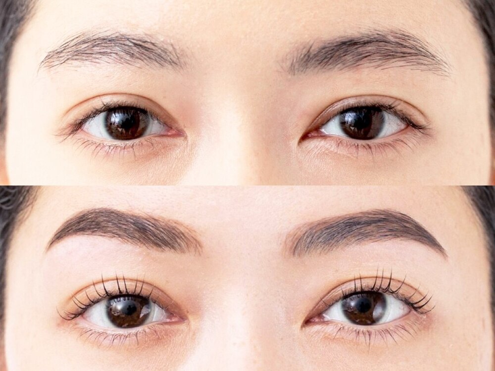 アートメイクのビフォーアフター