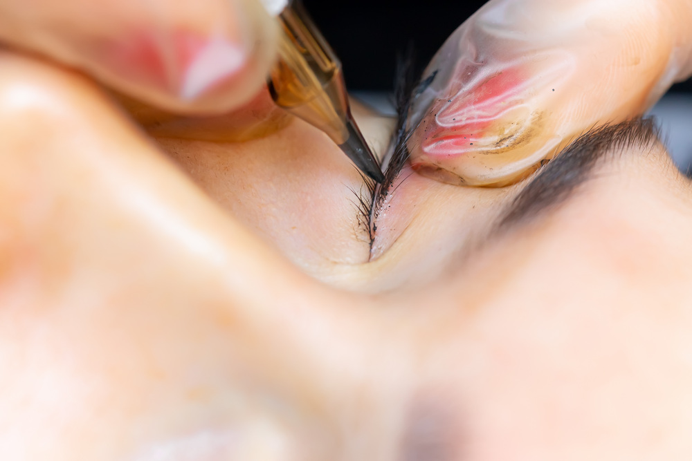 アートメイク（アイライン）施術中