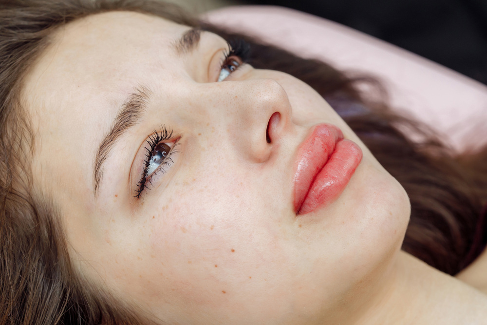 アートメイク（リップ）施術中