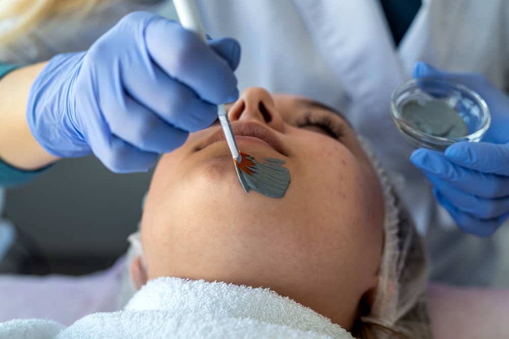 ピーリング施術中