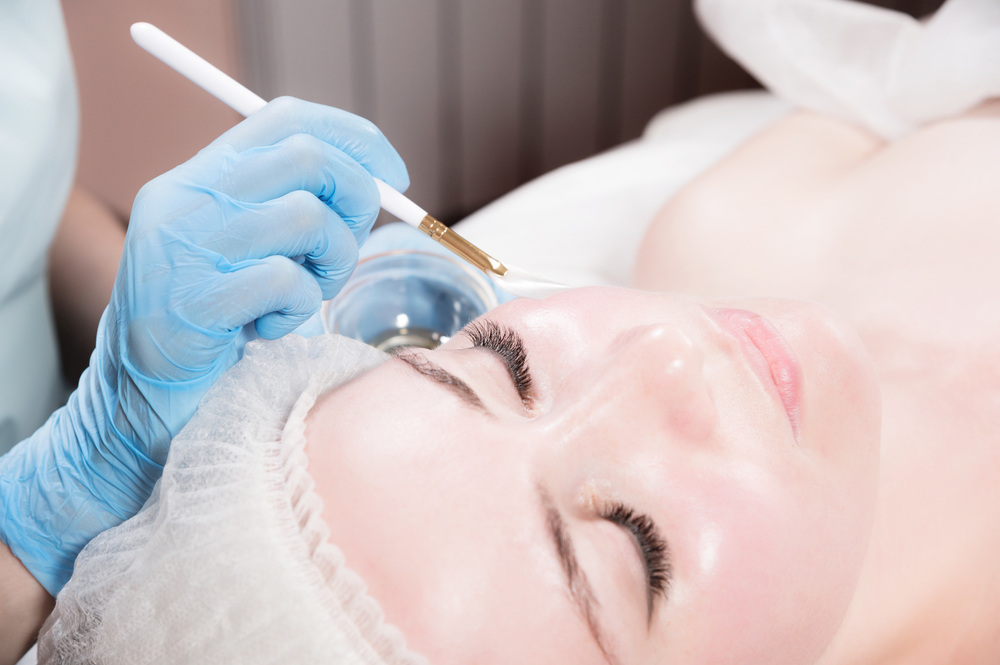 ピーリング施術中