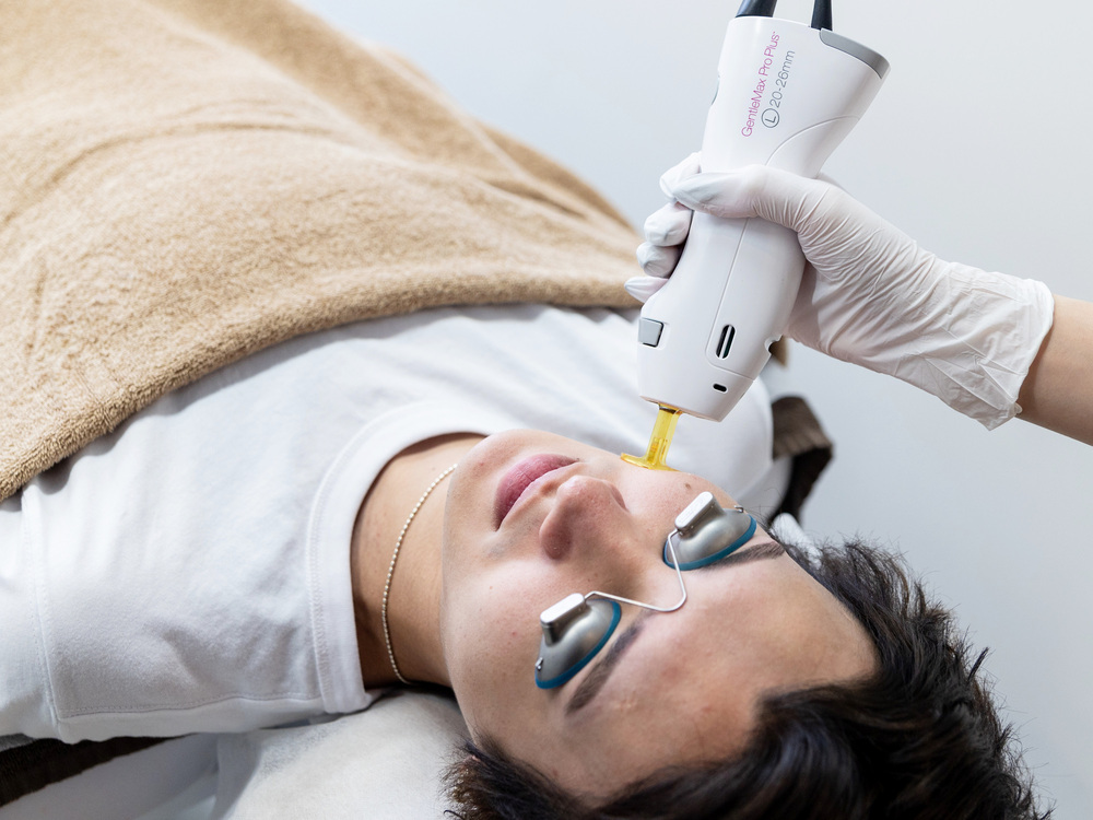 医療脱毛中の男性