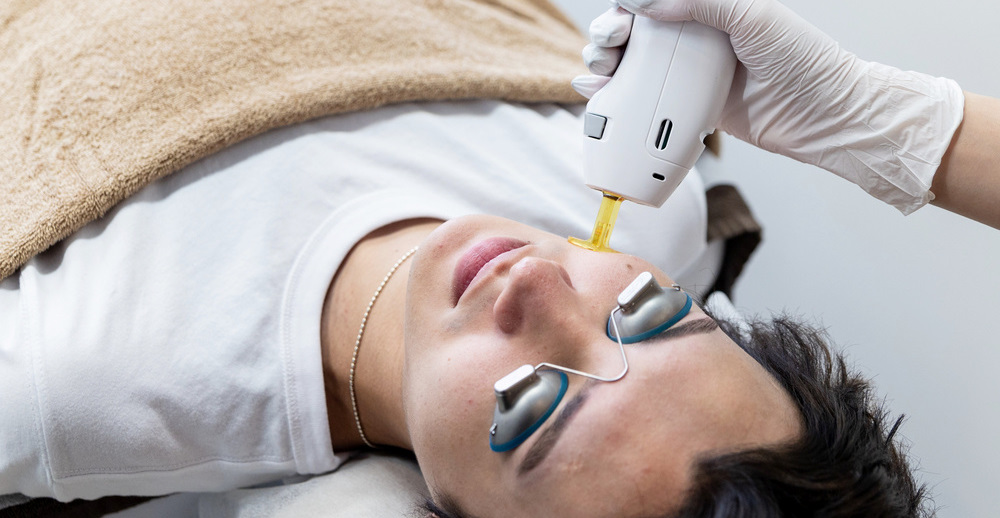 医療脱毛中の男性