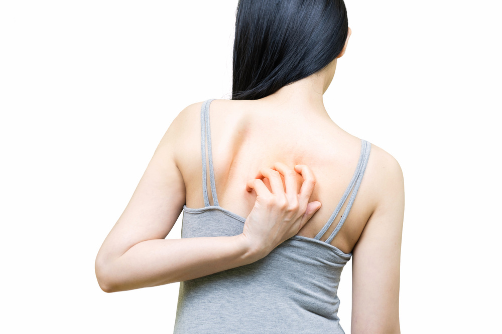 背中にできたニキビ