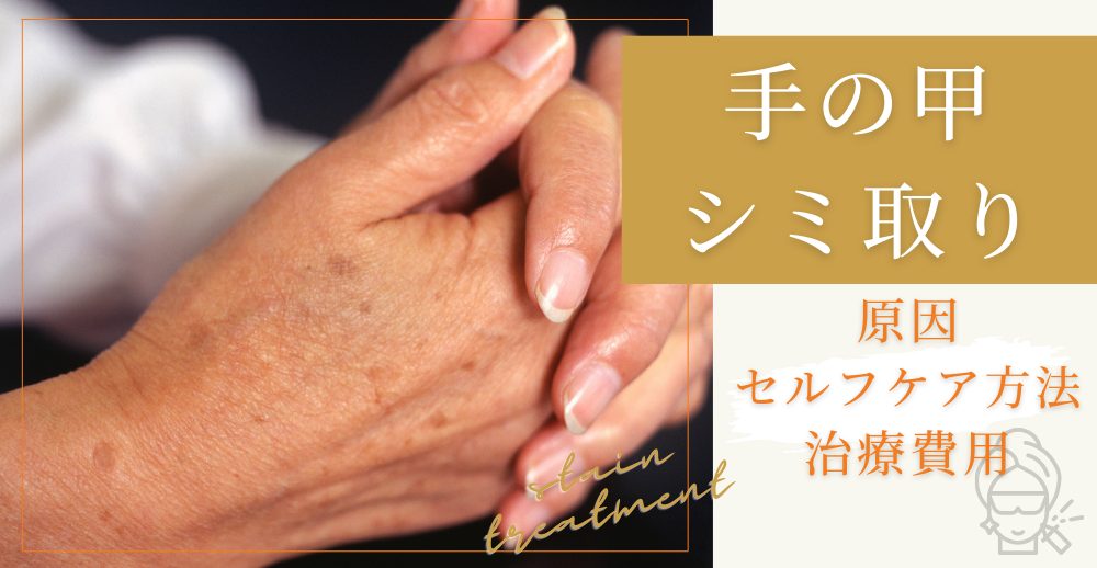 手の甲のシミ取り完全ガイド｜原因・セルフケア・皮膚科治療・費用