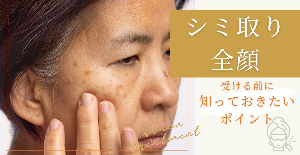 シミ取りを全顔で受ける前に知っておきたいこと