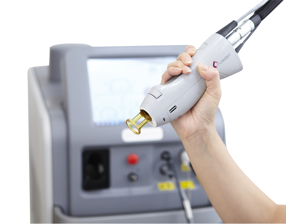 レーザー治療の機器