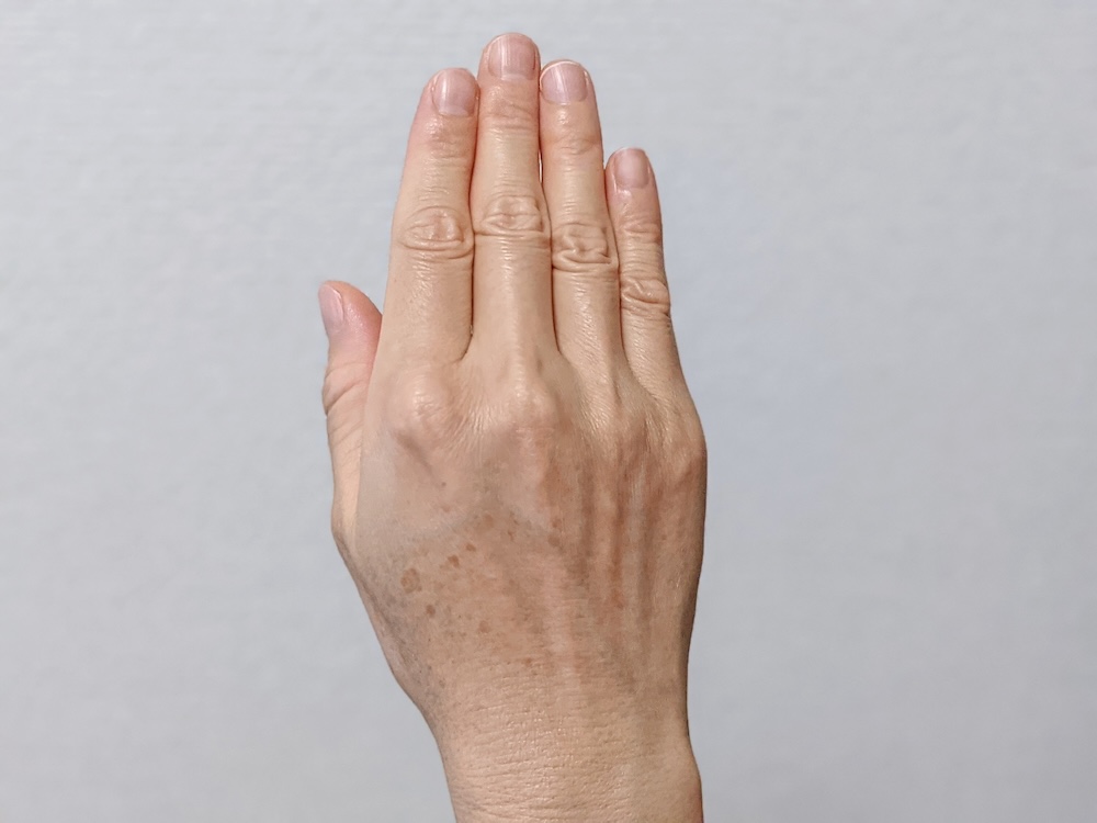 手の甲のシミ